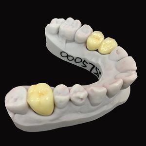 Restauración <span class=keywords><strong>fija</strong></span> Laboratorio dental asequible <span class=keywords><strong>Precio</strong></span> de China Puentes de corona de cerámica de metal <span class=keywords><strong>Precio</strong></span> barato Pfm - Product Image 4