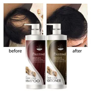 טיפולי פריסטין לצמיחה מחודשת של שיער מותג פרטי סט טיפוח שיער אורגני טבעי נגד נשירת שיער שמפו ומרכך ג'ינג'ר