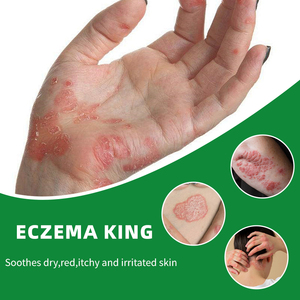 SmmlpunHerbal King Crema para picazón <span class=keywords><strong>tiña</strong></span> hidratante toxina pomada antibacteriana externa venta al por mayor cuidado de la piel del pie - Product Image 3