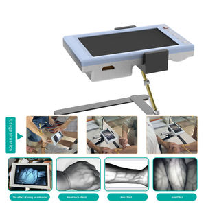 Visualizador de Venas Portátil con Pantalla LCD, Infrarrojo, para Uso Veterinario y Humano, Detector de Venas Facial y Corporal - Product Image 2