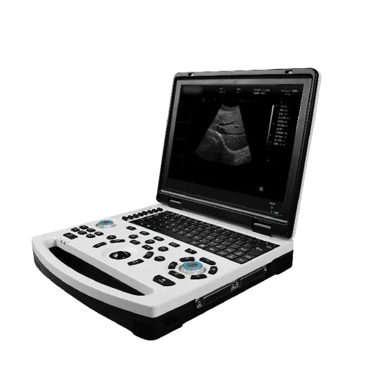 Scanner à ultrasons de diagnostic UBW690 Machine à ultrasons de type B/W pour ordinateur portable avec affichage médial LCD HD de 12.1 pouces