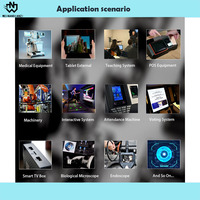 Weinan Electronics Mini 11MP 4K Módulo de cámara endoscópica USB UVC compatible con Plug-and-Play con enfoque automático