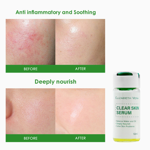 Suero para Piel Clara con Centella Asiática 10 ml - Esencia Facial Calmante para el Cuidado Profesional de las Imperfecciones, para una Tez Equilibrada y Refinada - Product Image 4