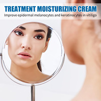 Pommade douce de traitement du vitiligo à usage externe pour la peau, crème éclaircissante pour les taches de sueur et le vitiligo - Offre Spéciale