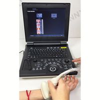 SY-A020E - Ordinateur portable vétérinaire - Écran LCD 12,1'' - Échographe Doppler couleur pour cardiologie/pédiatrie/urologie