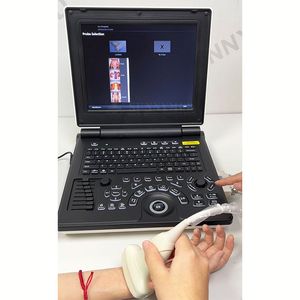 SY-A020E xách tay thú y máy tính xách tay 12.1 'LCD hiển thị siêu âm DOPPLER màu máy siêu âm cho tim/Nhi/tiết niệu - Product Image 4