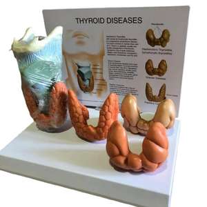 Modello di patologia tiroidea endocrinologia modello di visualizzazione della malattia della tiroide venduto come modello anatomico di scienza medica - Product Image 2