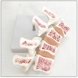 Modelo de lesión de osteoporosis de 4 vértebras médicas, modelo de esqueleto humano, anatomía, articulación, vértebras lumbares, modelo de esqueleto humano - Product Image 5