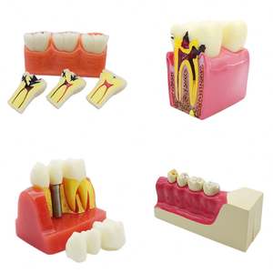 Tapón Dental 2x Grande, Cepillo de Dientes de Plástico/Niti/Acero Inoxidable, Eléctrico/Manual, Empaque Individual, Clase I para Enseñanza - Product Image 4