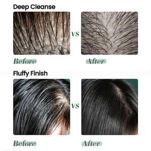 <span class=keywords><strong>Shampoo</strong></span> Nutriente e Riparatore per Capelli Danneggiati, con Biotina, Olio di Argan, Rosa, Cocco - Crescita dei Capelli, Volumizzante e Lucentezza - Product Image 4