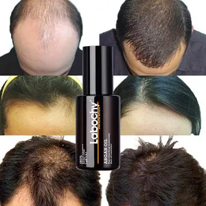 OEM Private Label Anti Hair Loss Serum 50ml Organic Hair Growth Oil Contain Shea Butter