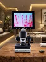 XW880 High Definition Vascular Observation and Analysis Instrument for Fingertip Surroundings Nail Fold Capillary Microscope