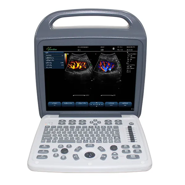 Scanner ad ultrasuoni Color Doppler per Laptop C10M