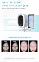 R AI Technology 3D Scanner facial intelligent Machine d'analyseur de peau du visage de diagnostic numérique Caméra numérique AI pour problème de peau