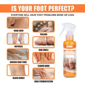 Espray de Peeling para pies, esencia para pedicura, removedor de callos de piel muerta, hidratante, blanqueador, cosméticos, cuidado de los pies