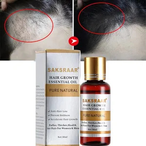 Óleo essencial para crescimento de cabelo, óleo original de ervas 100% natural para tratamento de perda de cabelo soro para crescimento