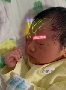 Alat Pencari Vena Berkualitas Baik, Portabel, Medis, Inframerah, Harga Pencari Vena - Product Image 3