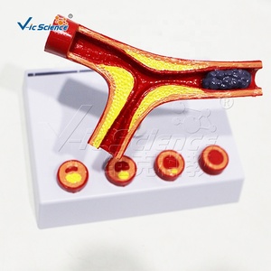 Modelo de Aterosclerosis y Trombosis de Arterias Cardiovasculares, Modelo de Obstrucción Patológica de Vasos Sanguíneos - Product Image 2
