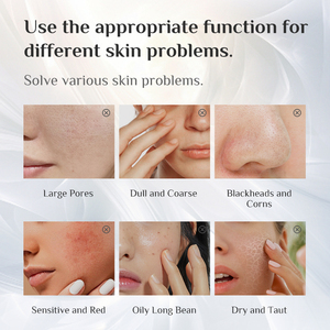 Nouveau Vaporisateur Facial Cosmétique Numérique à Ozone avec Support pour Machine de Nettoyage Profond de la Peau - Product Image 3