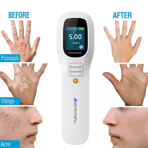 Lámpara de Fototerapia UV, Lámpara Láser Excimer de 308nm para <span class=keywords><strong>el</strong></span> Tratamiento de la Psoriasis, Vitíligo y Eccema, Lámpara de Mano UVB de Banda Pequeña - Product Image 2