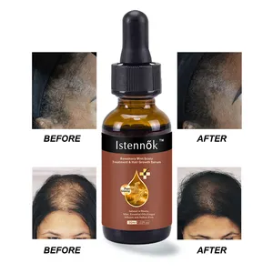 ISTENNOK Formula alami organik tonik jahe Rosemary kelapa minyak penumbuh rambut produk Keratin rambut rontok