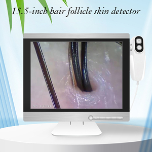 Sonda de Detección HD - Analizador de Cabello y Cuero Cabelludo SA-S15 de 10 Millones de Píxeles - Product Image 2