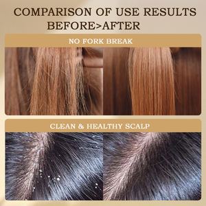 Shampooing <span class=keywords><strong>cheveux</strong></span> bouclés direct d'usine shampooing tête et épaules 500ml pour homme femmes usage domestique - Product Image 5