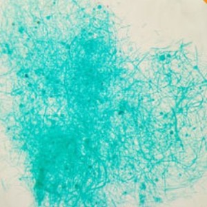 Fournisseur direct d'objectifs de microscope Mucor, de préparations microscopiques et d'équipements pédagogiques de biologie pour les niveaux primaire et secondaire. - Product Image 1