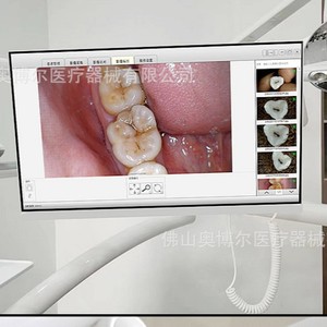 Dental Endoscope HM-368F 24-Inch Touchscreen Monitor With Wireless Wifi For Dental Diagnosis And Patient Management - Product Image 2