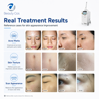 Machine laser fractionné CO2 10600nm pour resserrement vaginal et vulvaire, écran tactile 12 pouces, 7 bras, 166mJ, découpe ultra-pulsée continue, CE