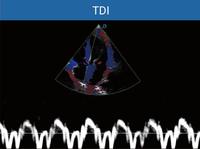 Appareil de diagnostic à ultrasons couleur Scanner à ultrasons exclusif Portable 3D/4D/5D Équipement à ultrasons médical