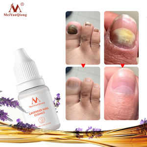 Tratamiento <span class=keywords><strong>de</strong></span> hongos en las uñas para hombres y mujeres, suero <span class=keywords><strong>de</strong></span> esencia para cuidado <span class=keywords><strong>de</strong></span> manos y pies, Gel <span class=keywords><strong>de</strong></span> reparación, antiinfeccioso, paroniquia, onicomicosis - Product Image 5