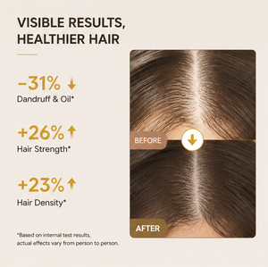 Serie de Cuidado Capilar con Jengibre, Champú y Acondicionador Anticaspa 2 en 1, Aceite Reparador con Péptidos de Cobre Azul para Cabello Dañado, Uso Doméstico - Product Image 3