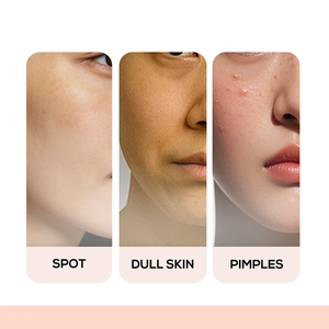 ครีมลดเลือนฝ้า กระ จุดด่างดำ รอยดำจากแดด สูตรเฉพาะ 10% ไนอะซินาไมด์ ขิง บิซาโบลอล รับผลิตแบบ OEM - Product Image 3