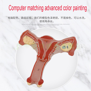 Mô Hình Giải Phẫu Nội Sinh Nữ Mô Hình Buồng Trứng Tử Cung Mô Hình Cấu Trúc Sinh Sản - Product Image 3