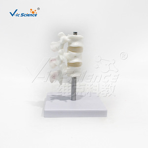 Modèle anatomique de colonne lombaire malade, modèle d'ostéoporose VIC-L034, ostéoporose de fémur humain. - Product Image 3