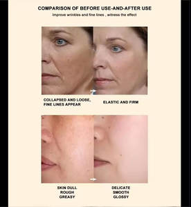 ACEITE FACIAL CON VITAMINA C Y NIACINAMIDA con Ácido Hialurónico y Vitamina E - Antienvejecimiento, Blanqueador, Sin Perfume para un Tono de Piel Uniforme - Product Image 6