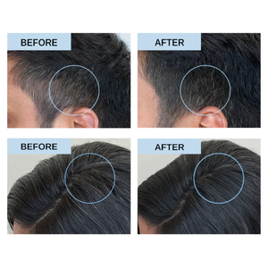 เซรั่มบำรุงผมปิดผมขาวสูตรเปปไทด์ แบรนด์ส่วนตัว เนื้อบางเบา ช่วยเร่งการเจริญเติบโตของเส้นผม ลดผมขาวอย่างเห็นได้ชัด - Product Image 4