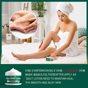 Private-Label-natural-nutritivo-reparador <span class=keywords><strong>de</strong></span> pies-<span class=keywords><strong>Crema</strong></span> <span class=keywords><strong>de</strong></span> talón agrietado-Proveedores Foot Spa <span class=keywords><strong>Urea</strong></span> Anti Crack <span class=keywords><strong>Crema</strong></span> <span class=keywords><strong>de</strong></span> manos y pies - Product Image 2