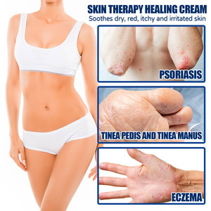 Crema para el Cuidado de <span class=keywords><strong>la</strong></span> <span class=keywords><strong>Piel</strong></span> SouthMoon, Fórmula Suave, Nutre el Cuerpo, Alivia el Enrojecimiento, Proporciona un Efectivo <span class=keywords><strong>Tratamiento</strong></span> Antifúngico para Todo Tipo de <span class=keywords><strong>Piel</strong></span> - Product Image 2