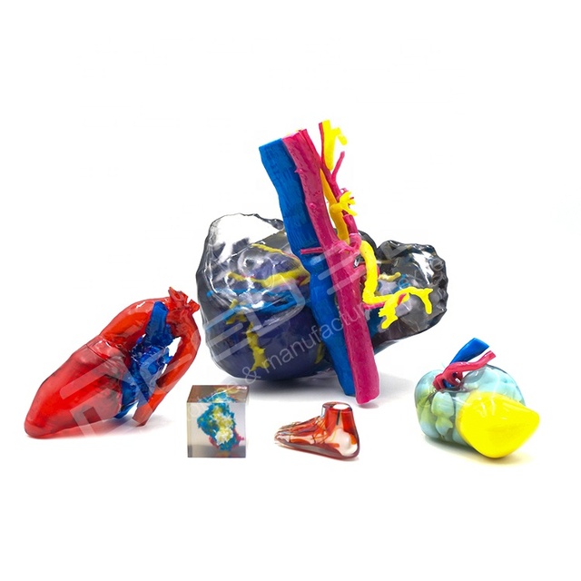 Stratasys Polyjet Full Color 3D Printing Service Customized Mixed Multi Material Medical Model Lung Orthopedics Surgery Model