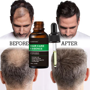 Sérum nourrissant pour la croissance des cheveux biologique à étiquette privée avec formule 2-en-1 pour les soins capillaires et la prévention de la perte de cheveux - Product Image 3