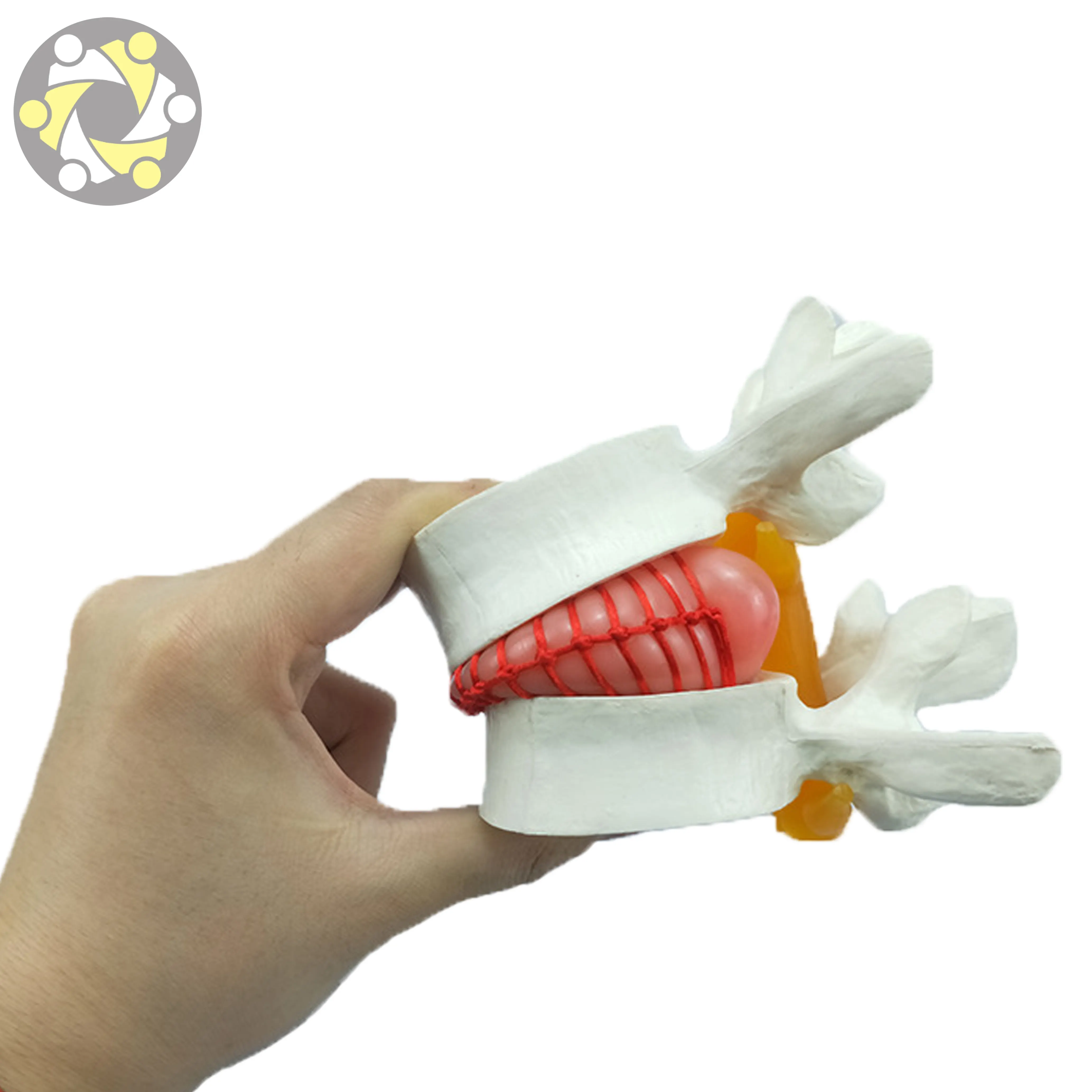 Medical Science Pathological Human Lumbar Disc Herniation Demonstration Model for Teaching