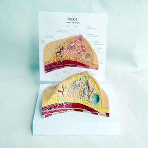 Modelo Anatómico de Seno Humano para Patología y Enfermedades, Material de PVC para Aprendizaje y Entrenamiento en Ciencias Médicas - Product Image 4