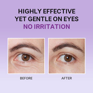 OEM Private Label Deep <strong>Wrinkle</strong> <strong>Filler</strong> Eye <strong>Cream</strong> with Retinol Hyaluronic Acid and Caffeine for Dark Circles Puffiness Eye Care - Product Image 6