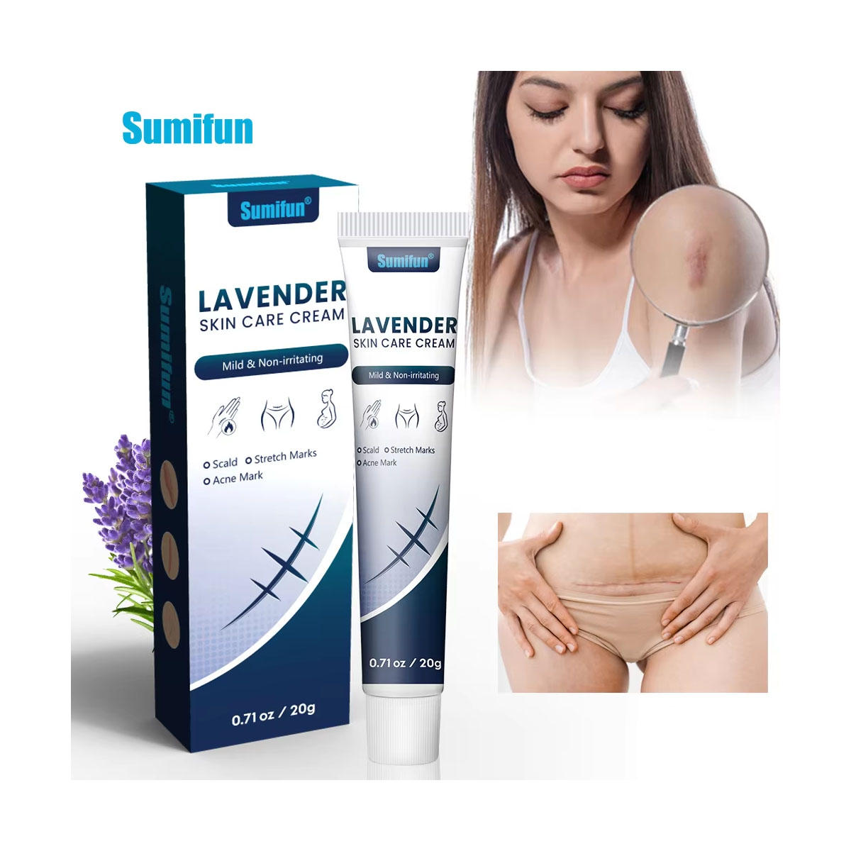 Sumifun Herbal Effective Skin Repairing Gel Natural Acne Mark Stretch Marks Removing Cream 20G
