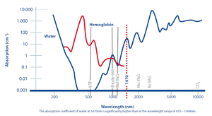 Điều trị tĩnh mạch giãn bằng laser Diode EVLT CHERYLAS 1470nm mới, công suất 45W, bền bỉ, có thể điều chỉnh. - Product Image 6