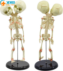 Modelo de Esqueleto Humano de Bebé para Ciencias Médicas, Esqueleto de Feto de Doble Cabeza, Modelo de Cráneo con Deformidad, Recurso Experimental - Product Image 1