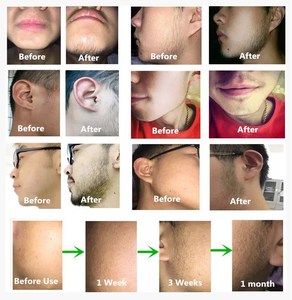Huile de croissance <span class=keywords><strong>pour</strong></span> barbe et <span class=keywords><strong>moustache</strong></span>, huile de croissance <span class=keywords><strong>pour</strong></span> barbe, huile de croissance <span class=keywords><strong>pour</strong></span> barbe bio - Product Image 3