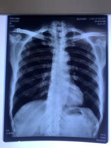 Phim Fuji 3500 Máy In Nhiệt 2000 2000 Lite Phim Nhiệt Y Tế Cho CT DR MRI - Product Image 3